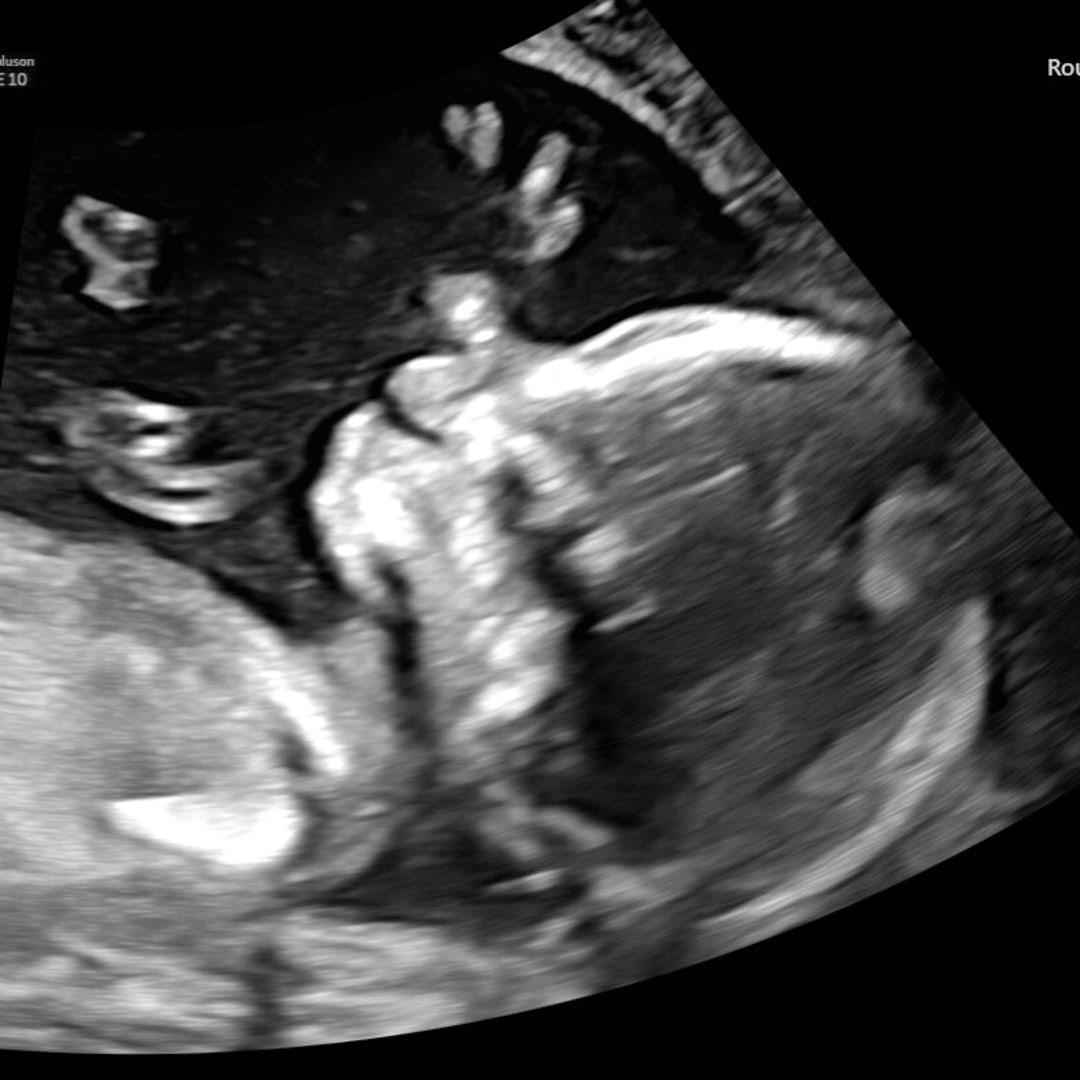 Photo shared by Geniva for their Babylist baby registry.