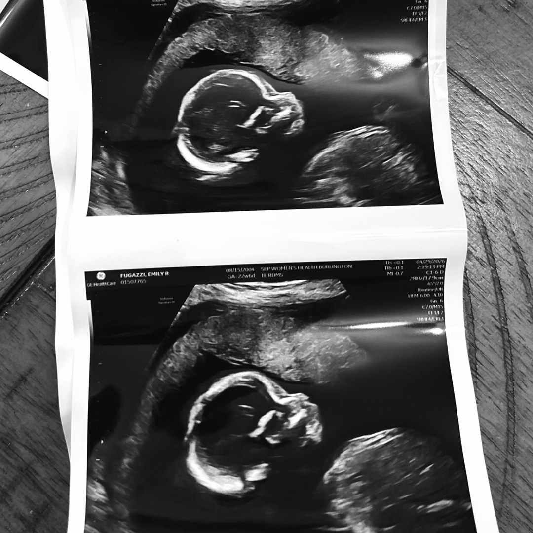 Photo shared by Emily for their Babylist baby registry.