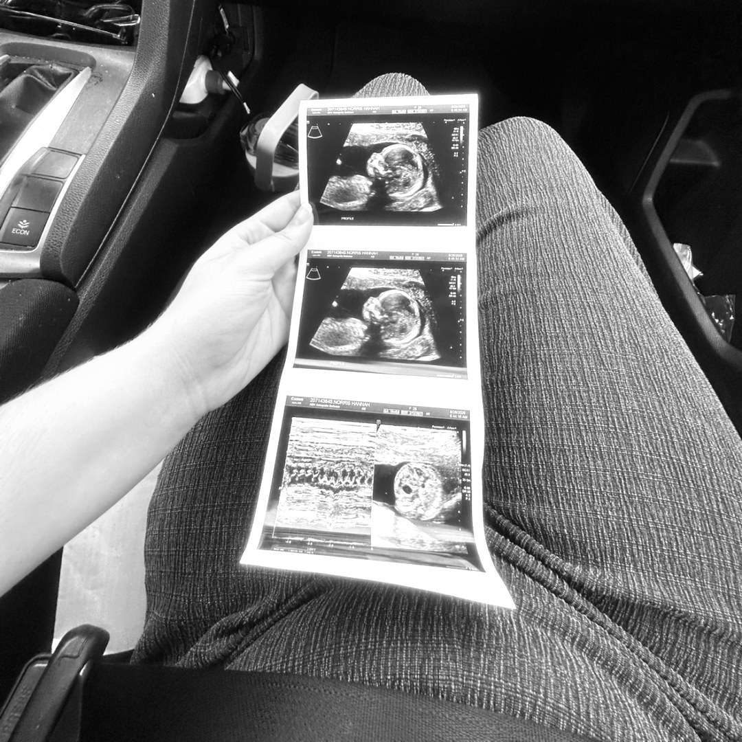 Photo shared by Hannah for their Babylist baby registry.