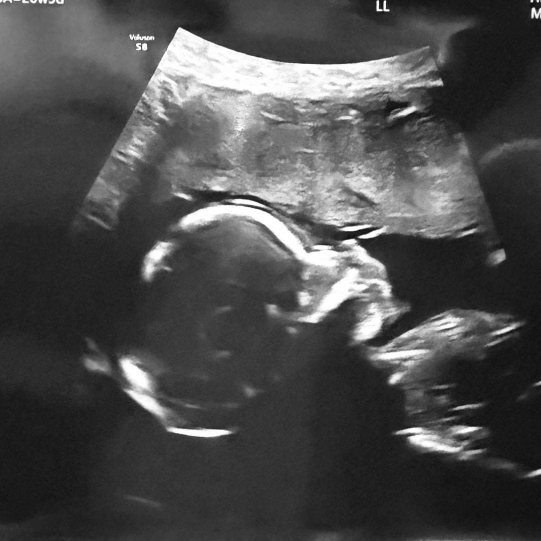 Photo shared by BreAnna for their Babylist baby registry.