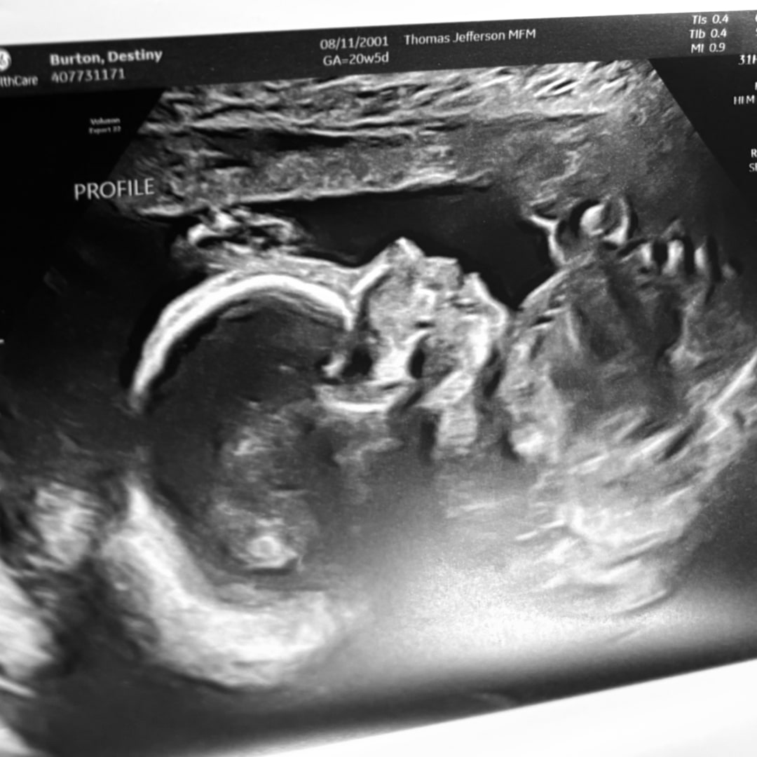 Photo shared by Destiny for their Babylist baby registry.