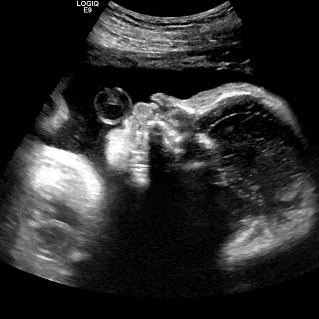 Photo shared by Nichole for their Babylist baby registry.