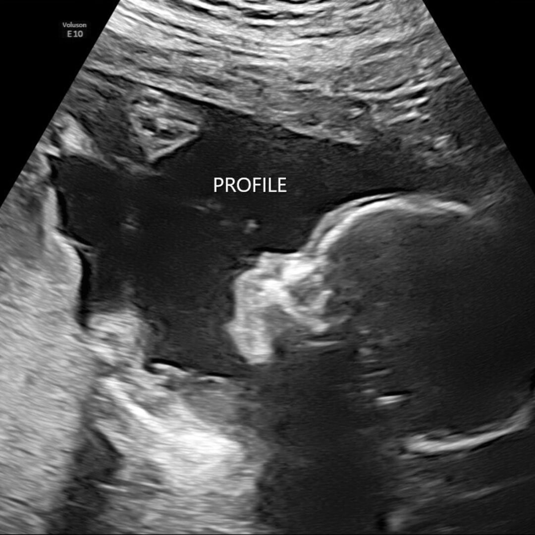 Photo shared by Rachel for their Babylist baby registry.