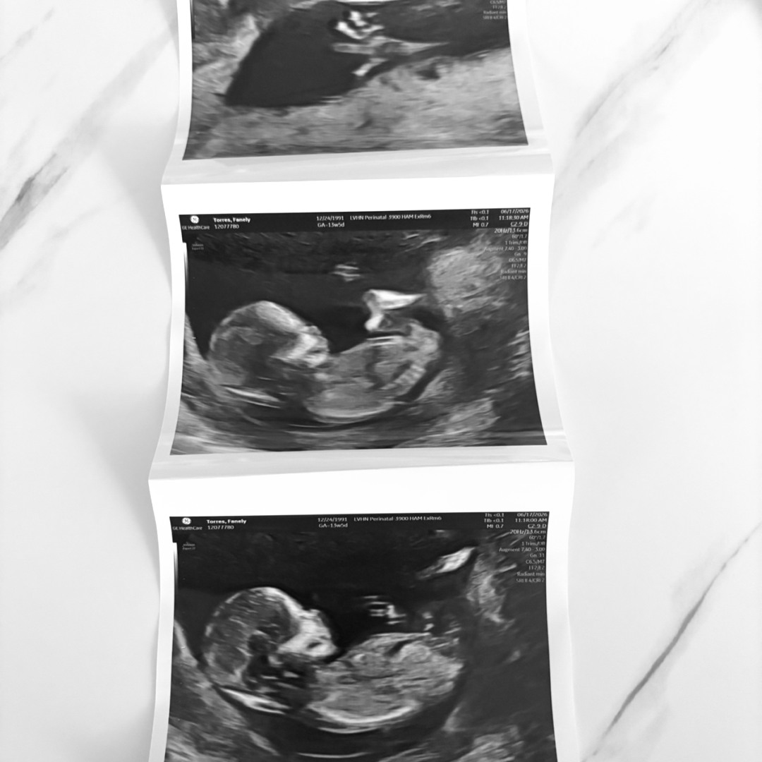 Photo shared by Fanely for their Babylist baby registry.