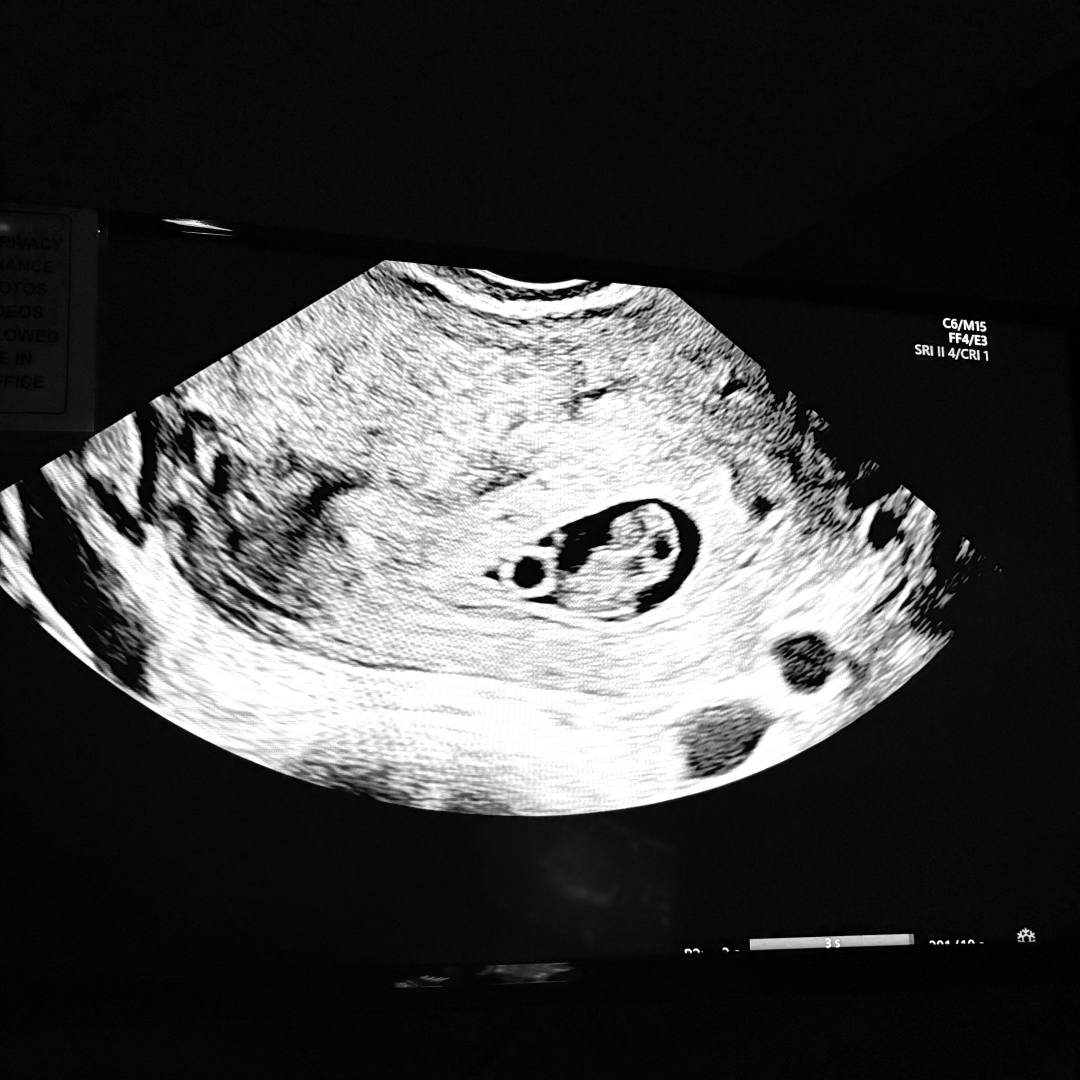 Photo shared by Lindsay for their Babylist baby registry.