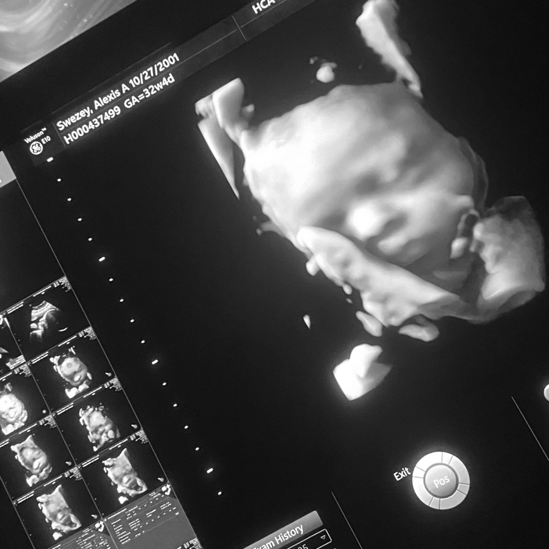 Photo shared by Alexis for their Babylist baby registry.