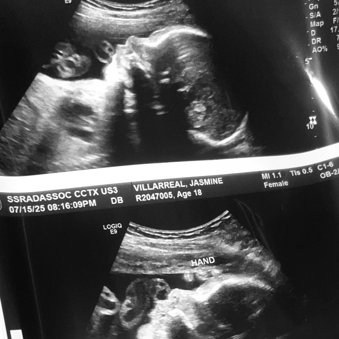 Photo shared by Jasmine for their Babylist baby registry.