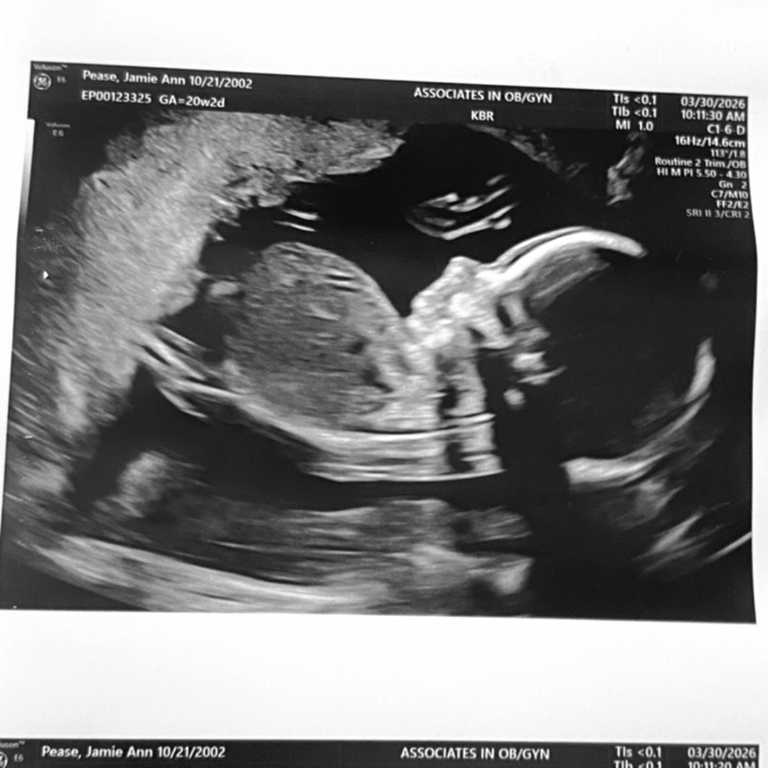 Photo shared by Jamie for their Babylist baby registry.