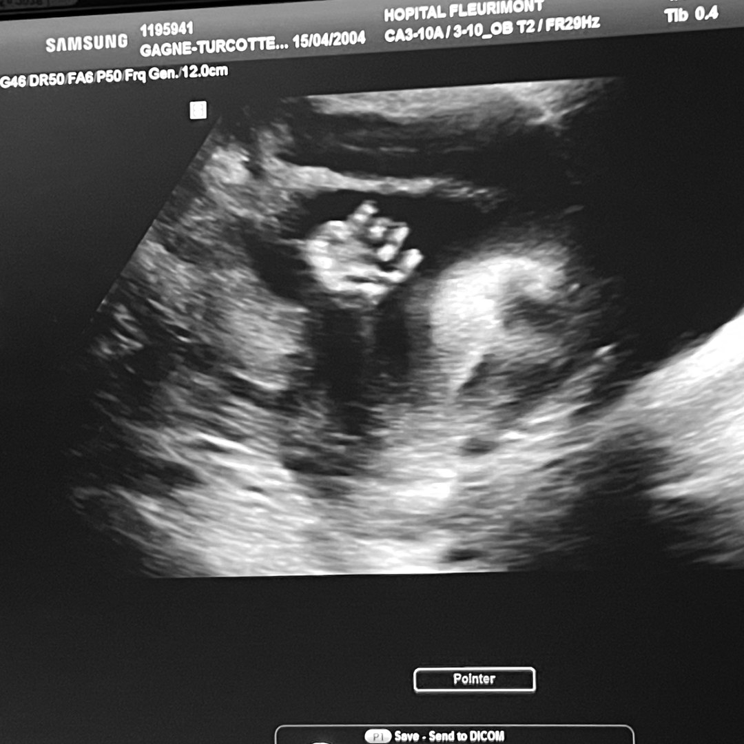 Photo shared by Alyson for their Babylist baby registry.