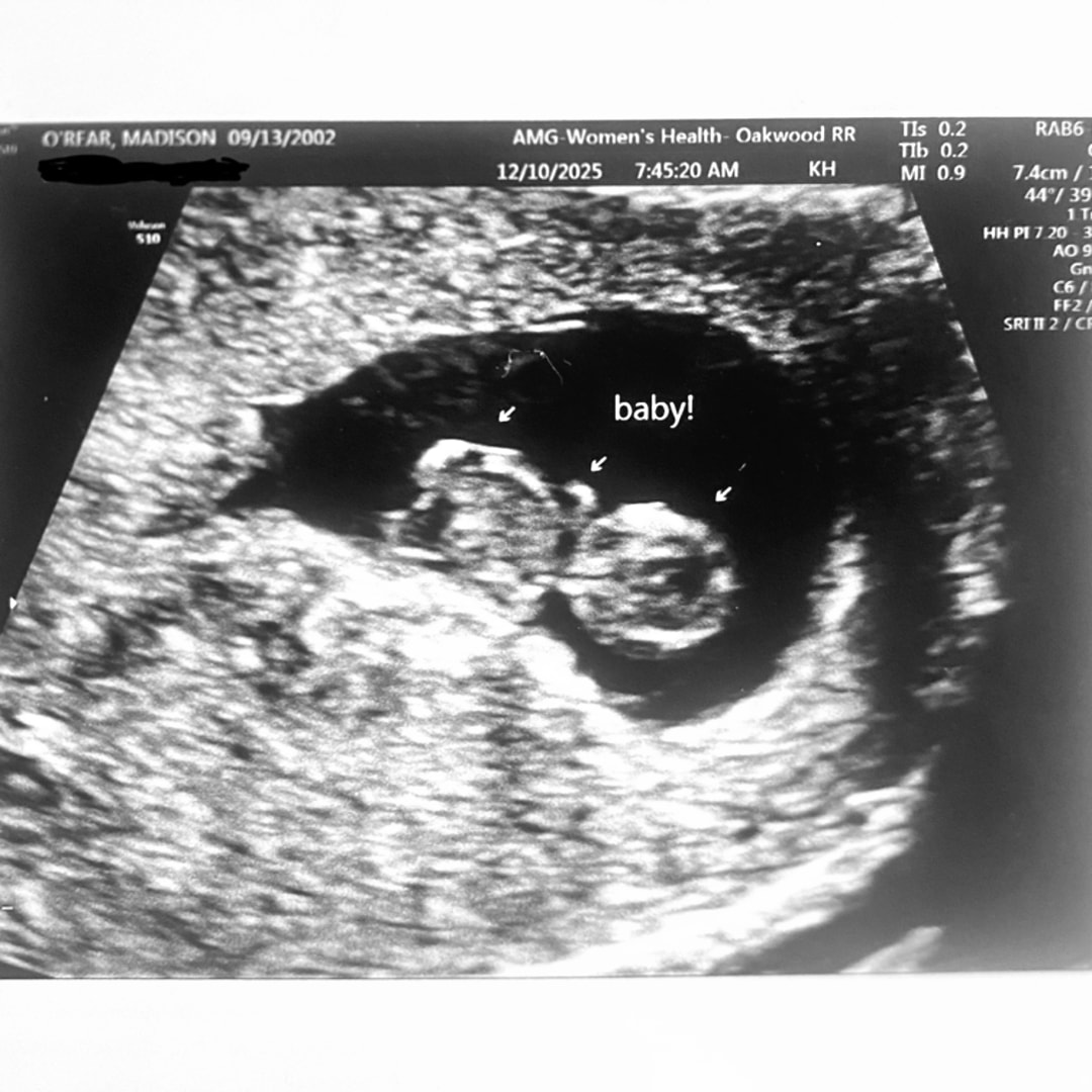 Photo shared by Madison for their Babylist baby registry.