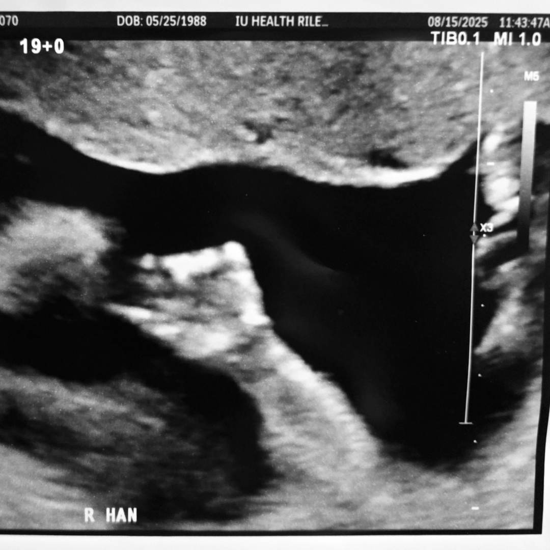 Photo shared by Dawn for their Babylist baby registry.