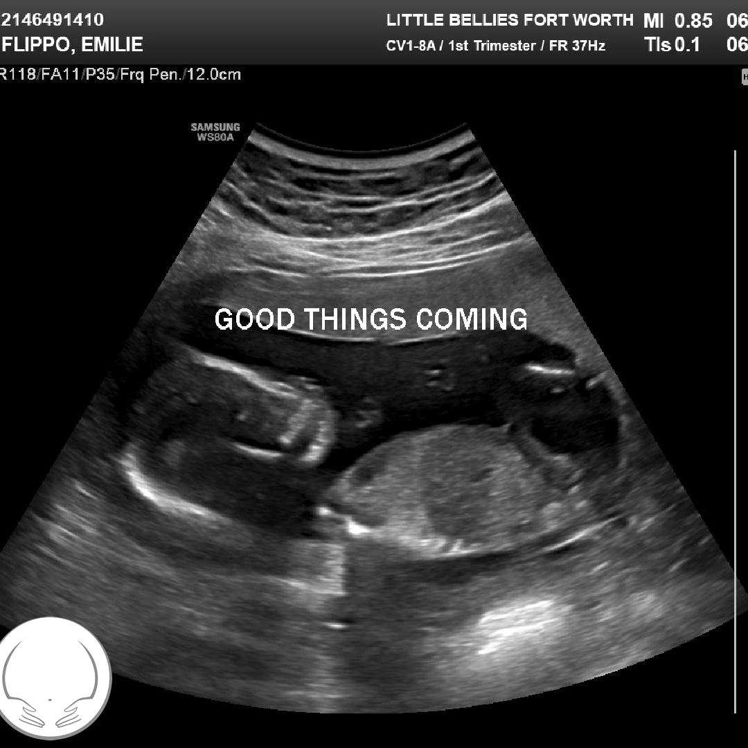 Photo shared by Emilie for their Babylist baby registry.