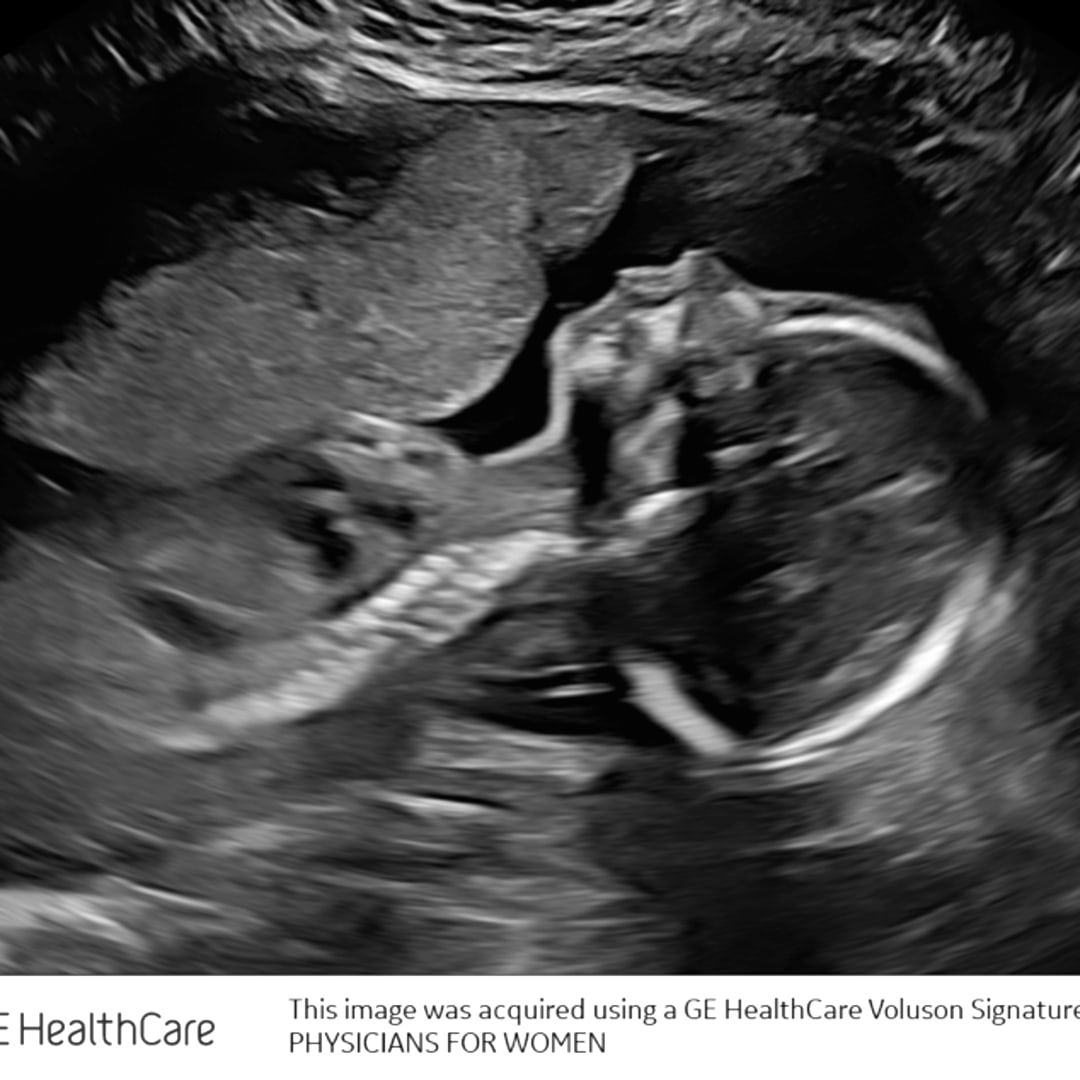 Photo shared by Savanna for their Babylist baby registry.