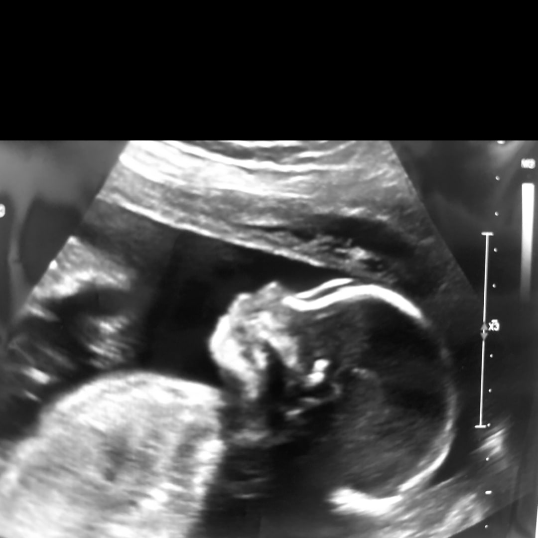 Photo shared by Jamari for their Babylist baby registry.