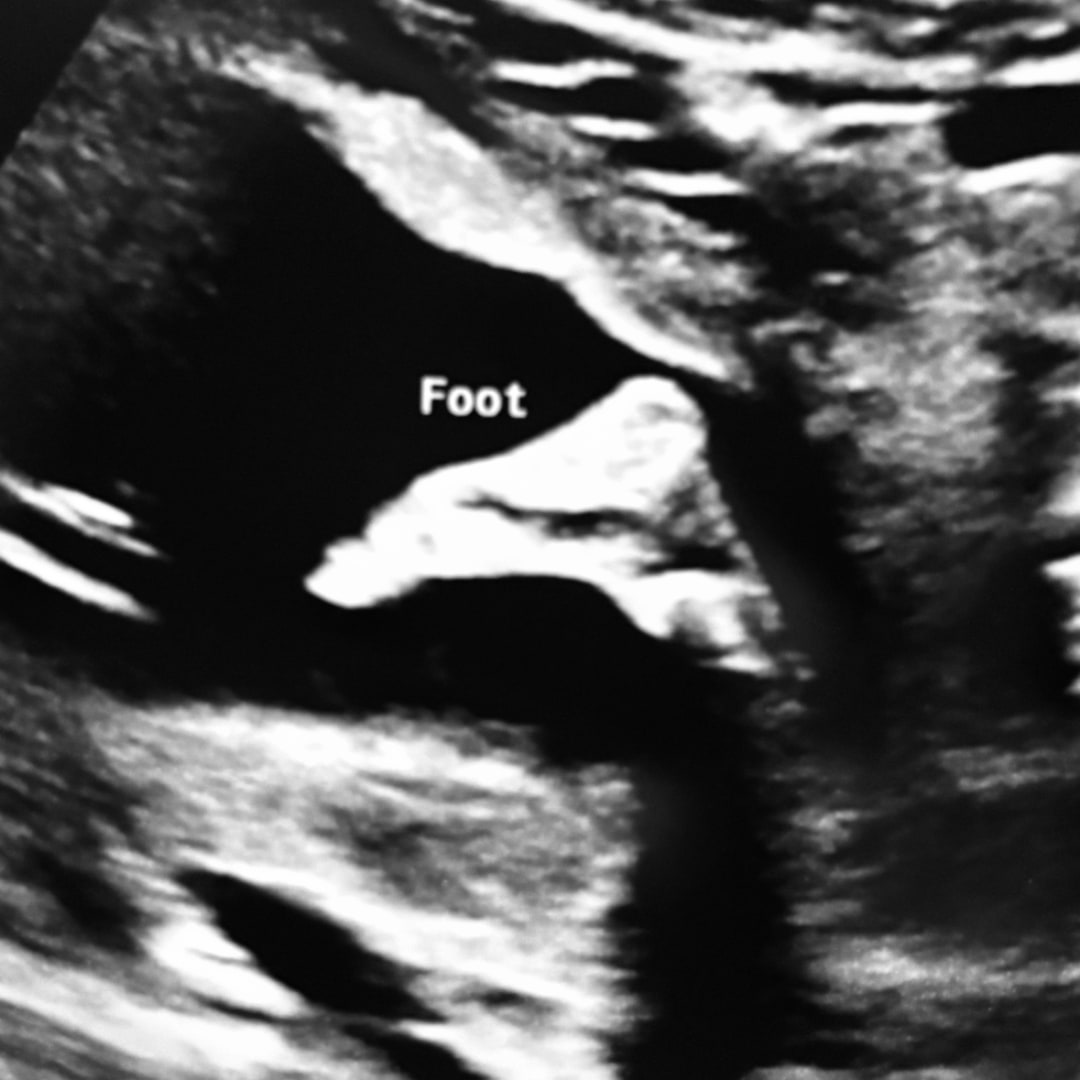 Photo shared by Stephanie for their Babylist baby registry.