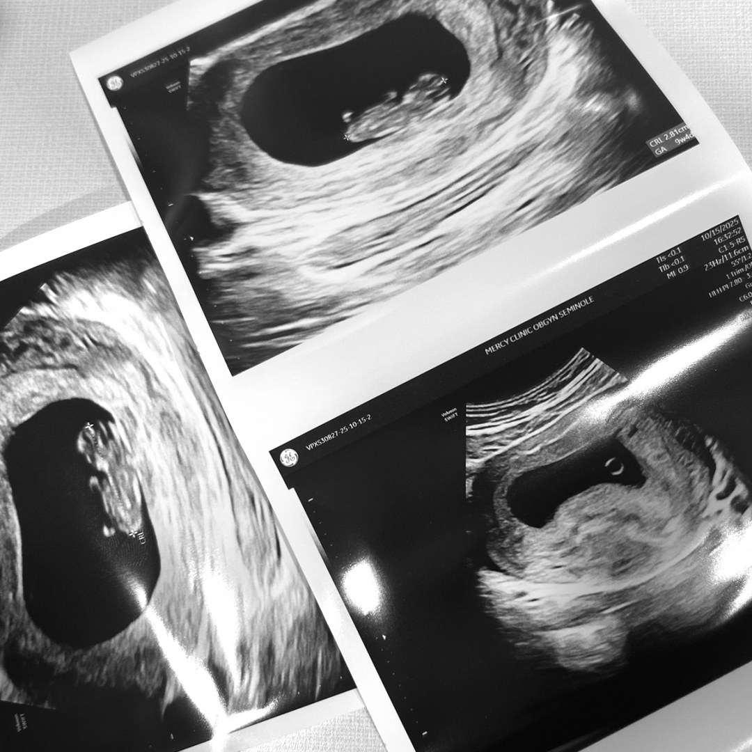 Photo shared by Taylor for their Babylist baby registry.