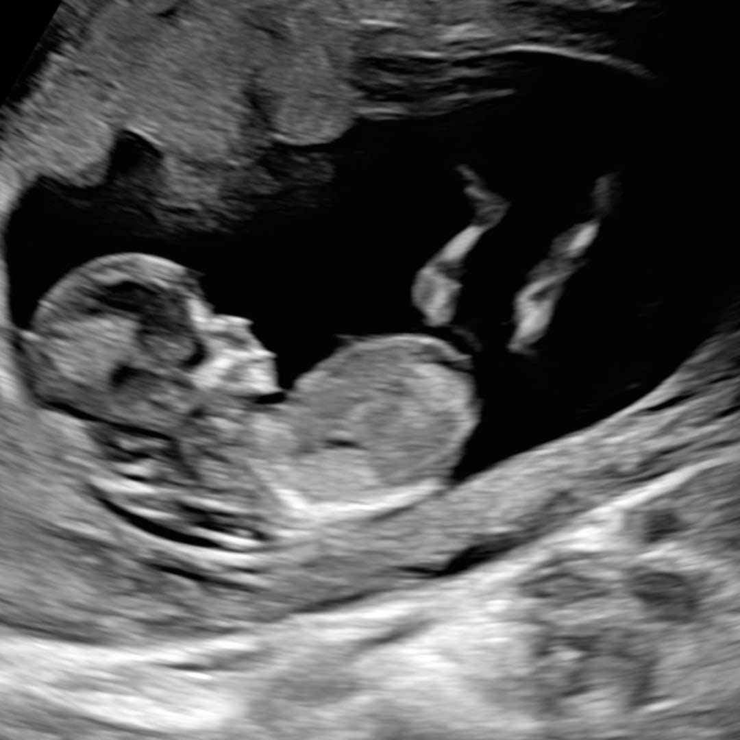 Photo shared by Daisy for their Babylist baby registry.