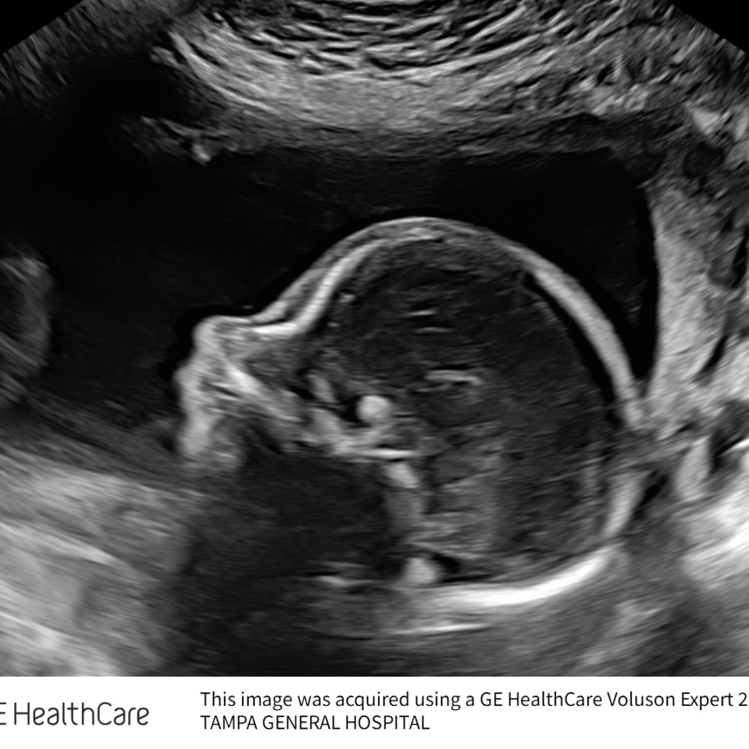 Photo shared by Amelia for their Babylist baby registry.