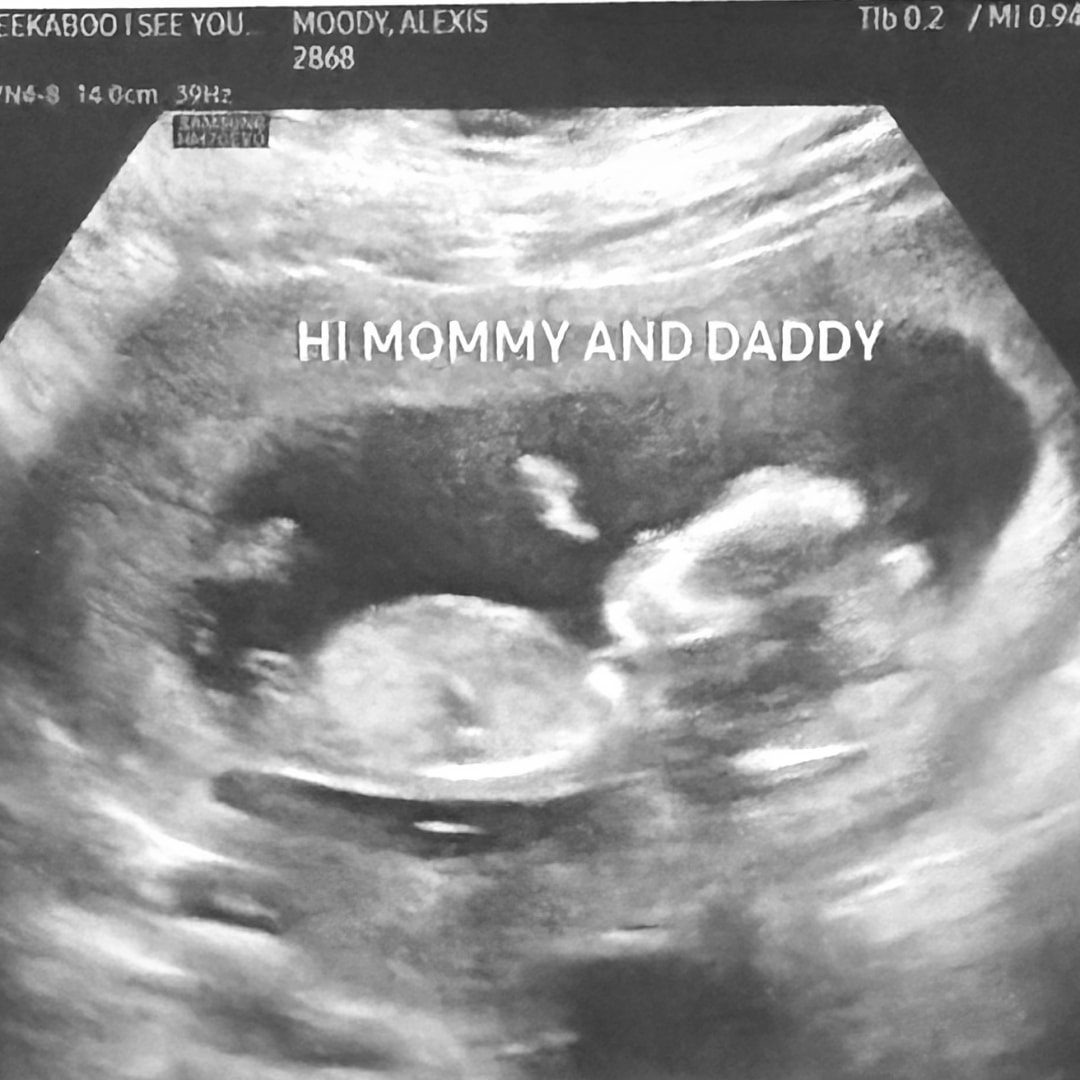 Photo shared by Lexi for their Babylist baby registry.