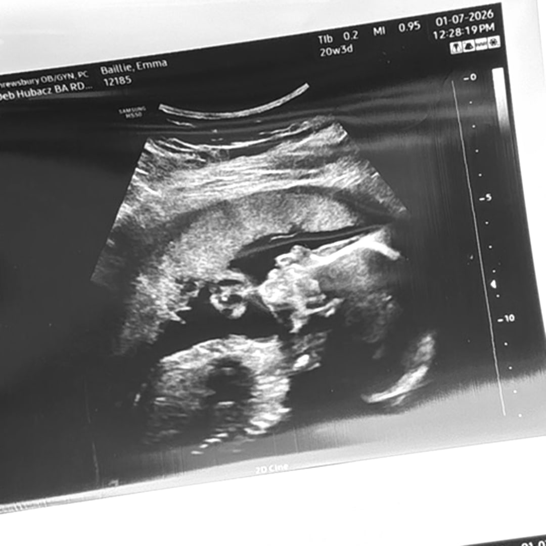 Photo shared by Emma for their Babylist baby registry.