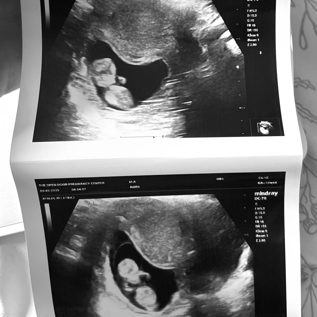 Photo shared by Amanda for their Babylist baby registry.