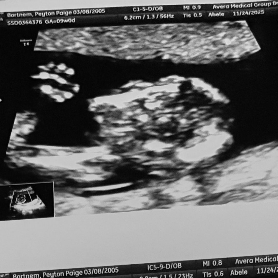 Photo shared by Peyton for their Babylist baby registry.