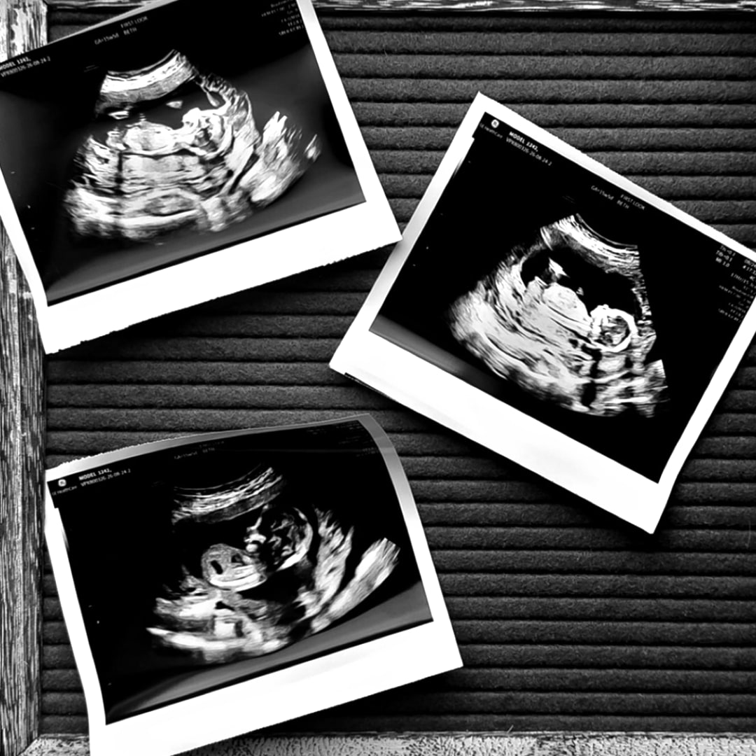 Photo shared by Cassie for their Babylist baby registry.