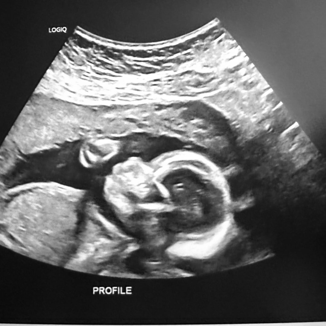 Photo shared by Aislinn for their Babylist baby registry.