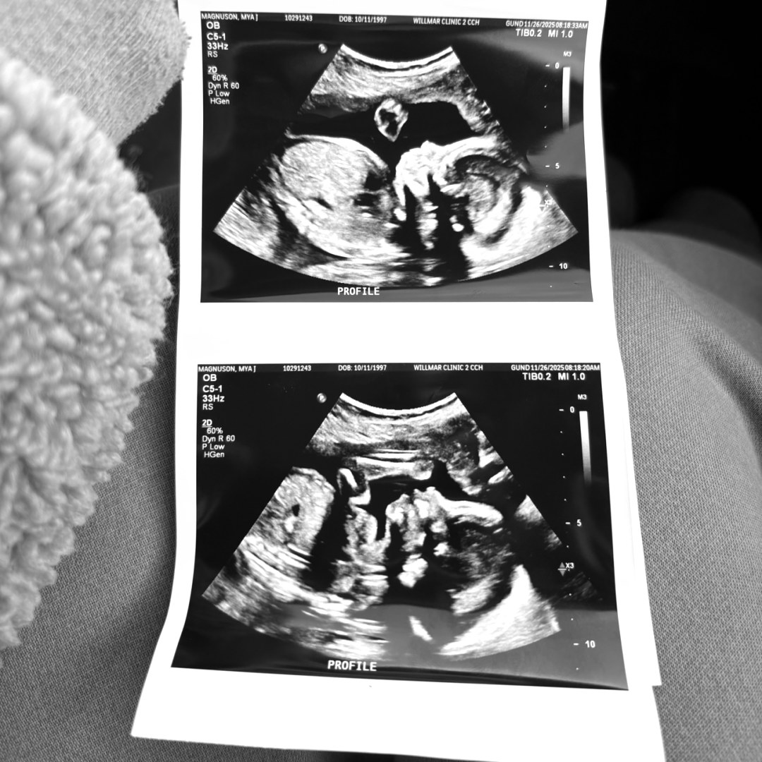 Photo shared by Mya for their Babylist baby registry.