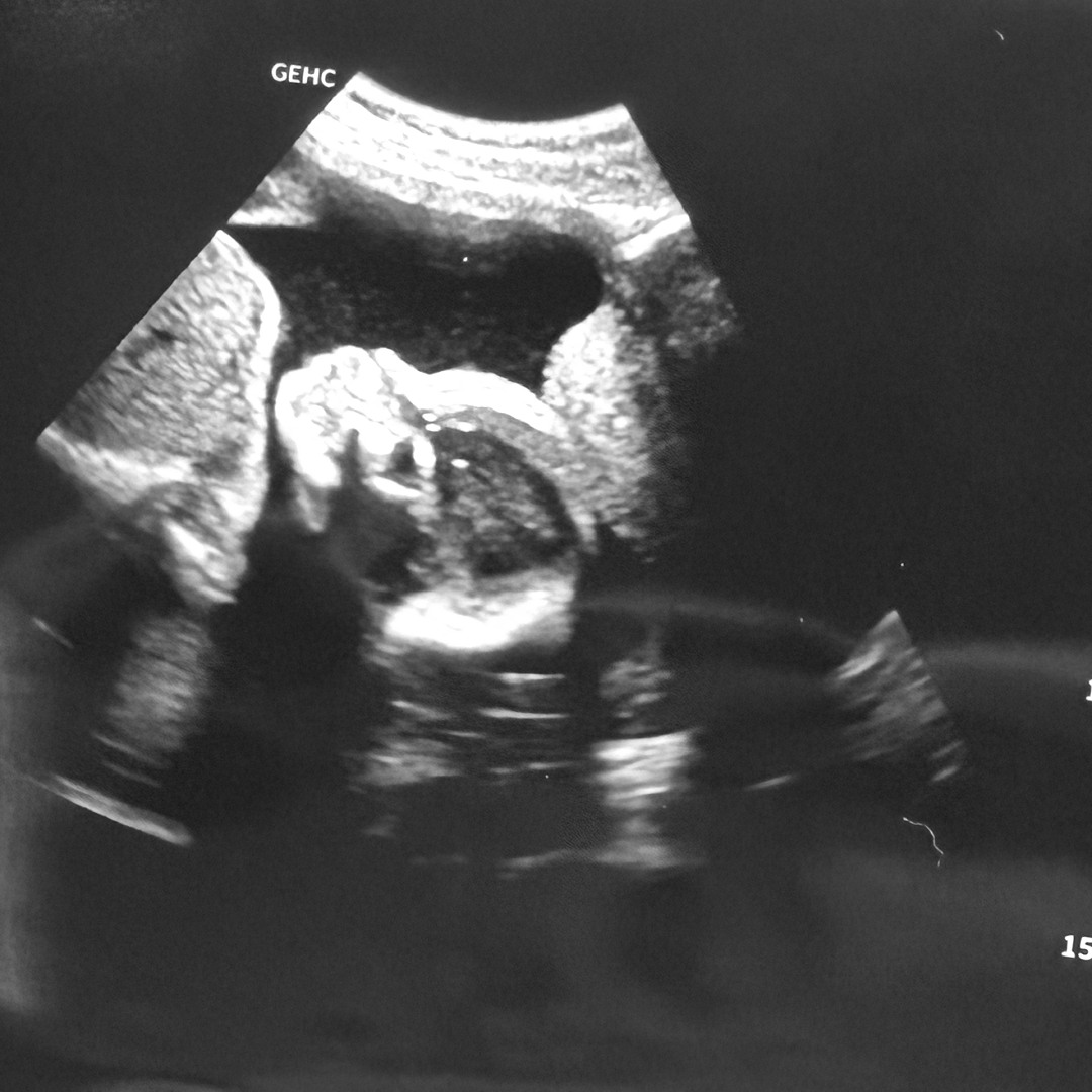 Photo shared by Caitlin for their Babylist baby registry.