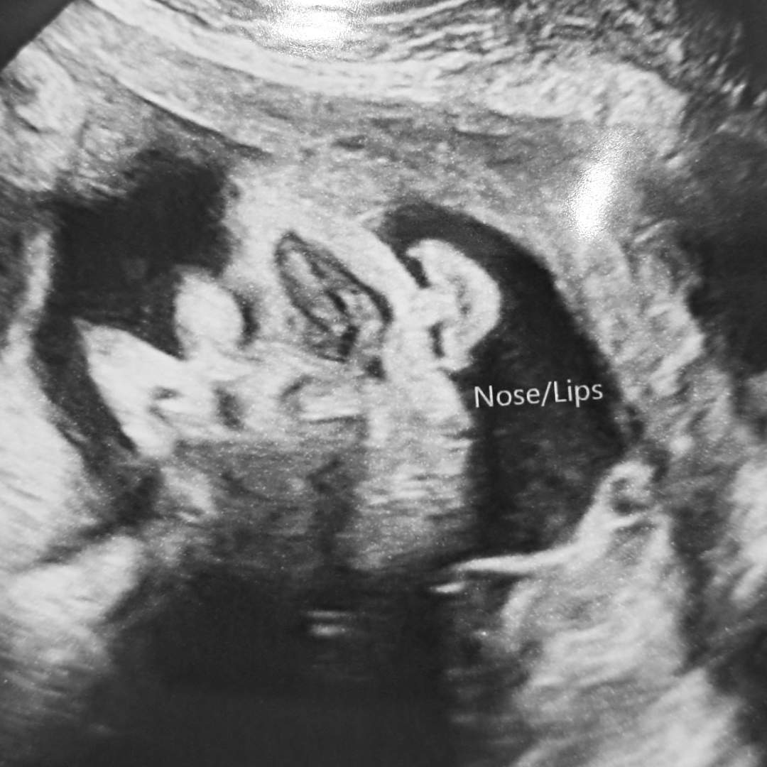 Photo shared by Ariella for their Babylist baby registry.