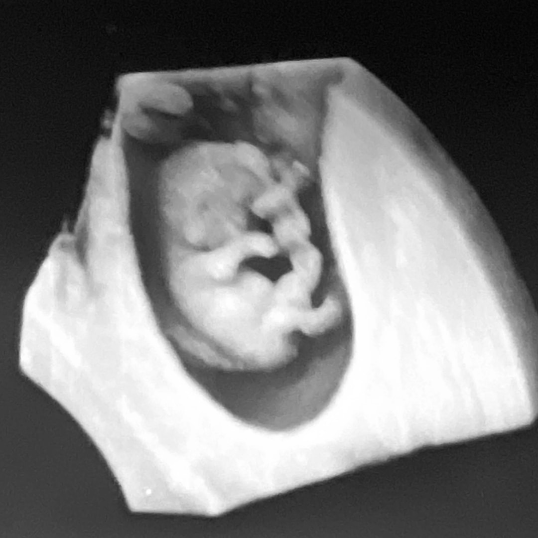 Photo shared by Getsemany for their Babylist baby registry.