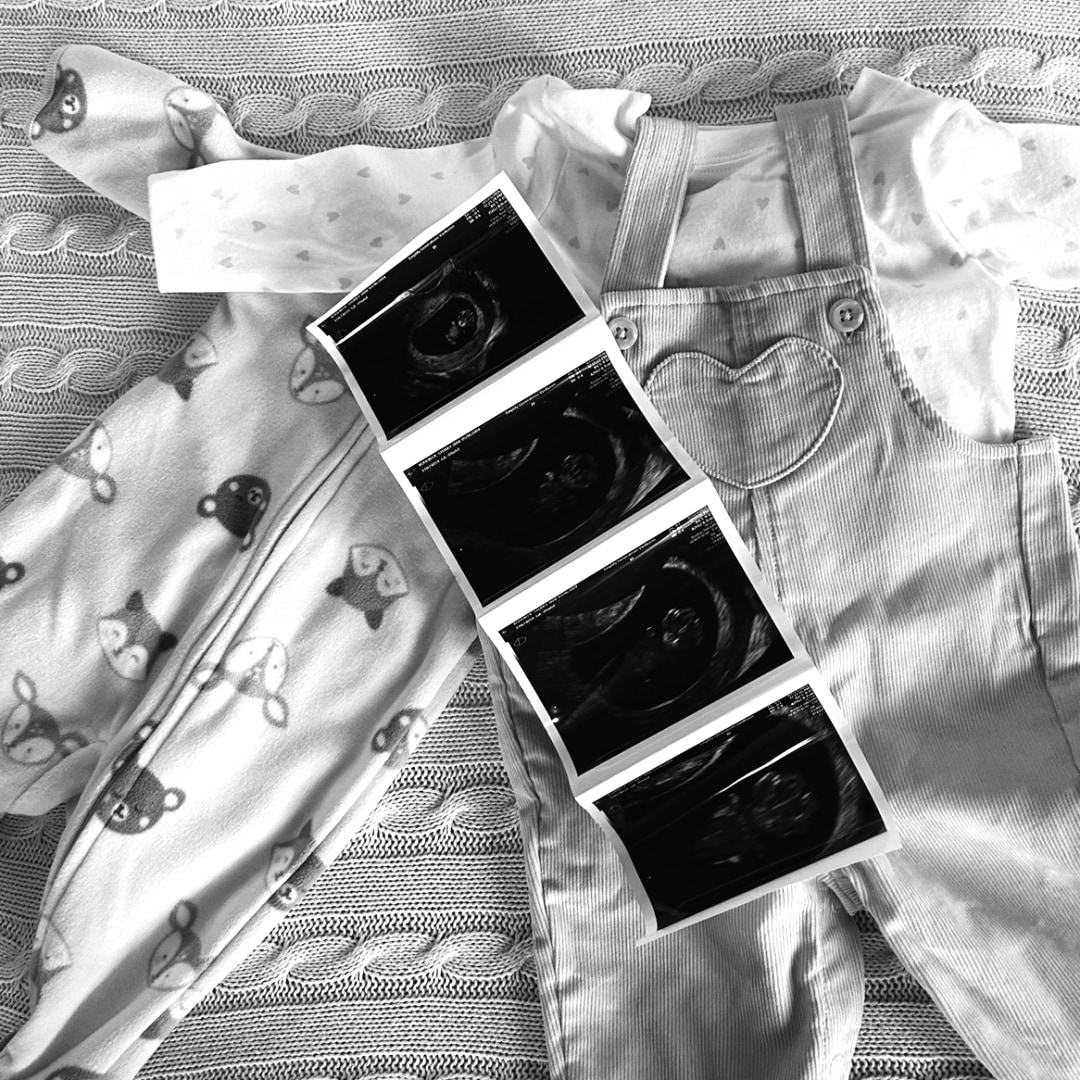 Photo shared by Sydney for their Babylist baby registry.