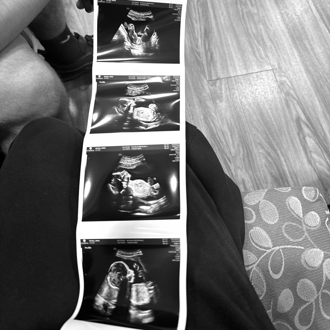 Photo shared by Mya for their Babylist baby registry.