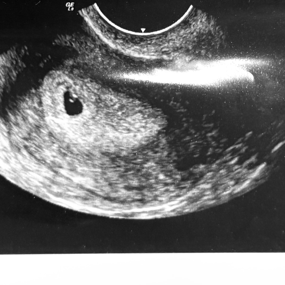 Photo shared by Cassandra for their Babylist baby registry.
