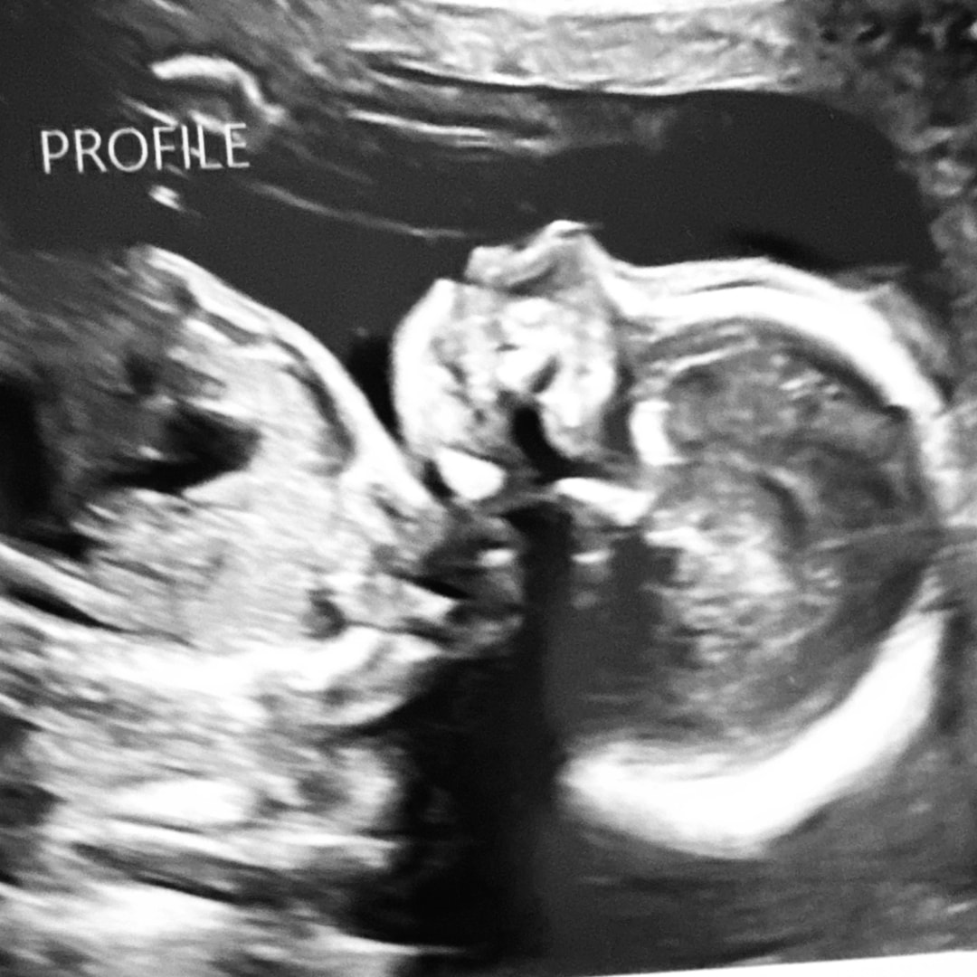 Photo shared by Alexa for their Babylist baby registry.