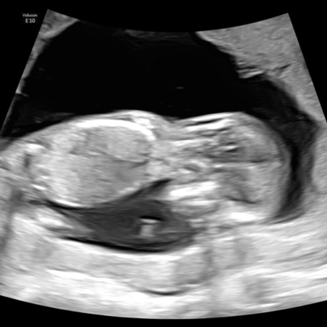 Photo shared by Emma for their Babylist baby registry.