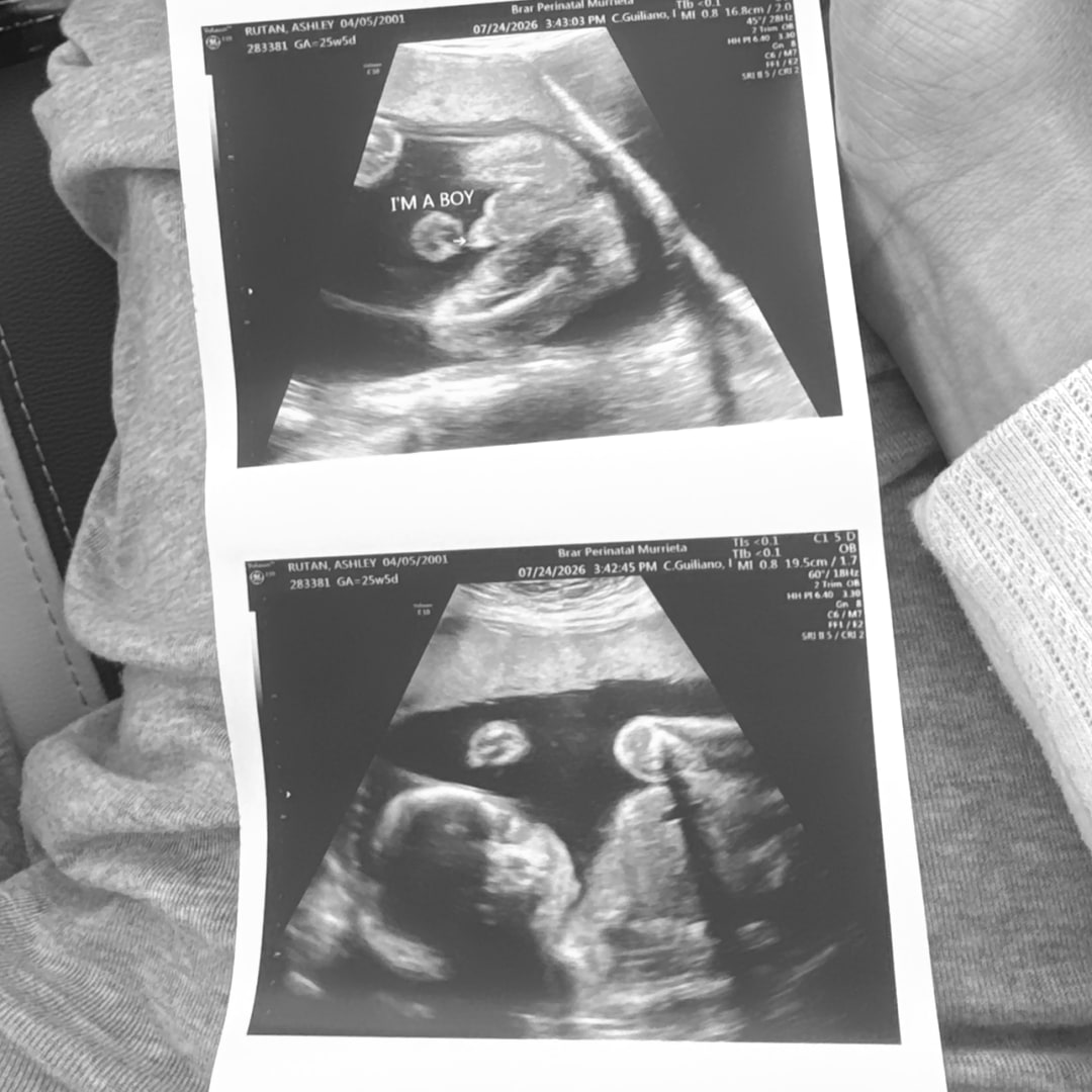 Photo shared by Ashley for their Babylist baby registry.