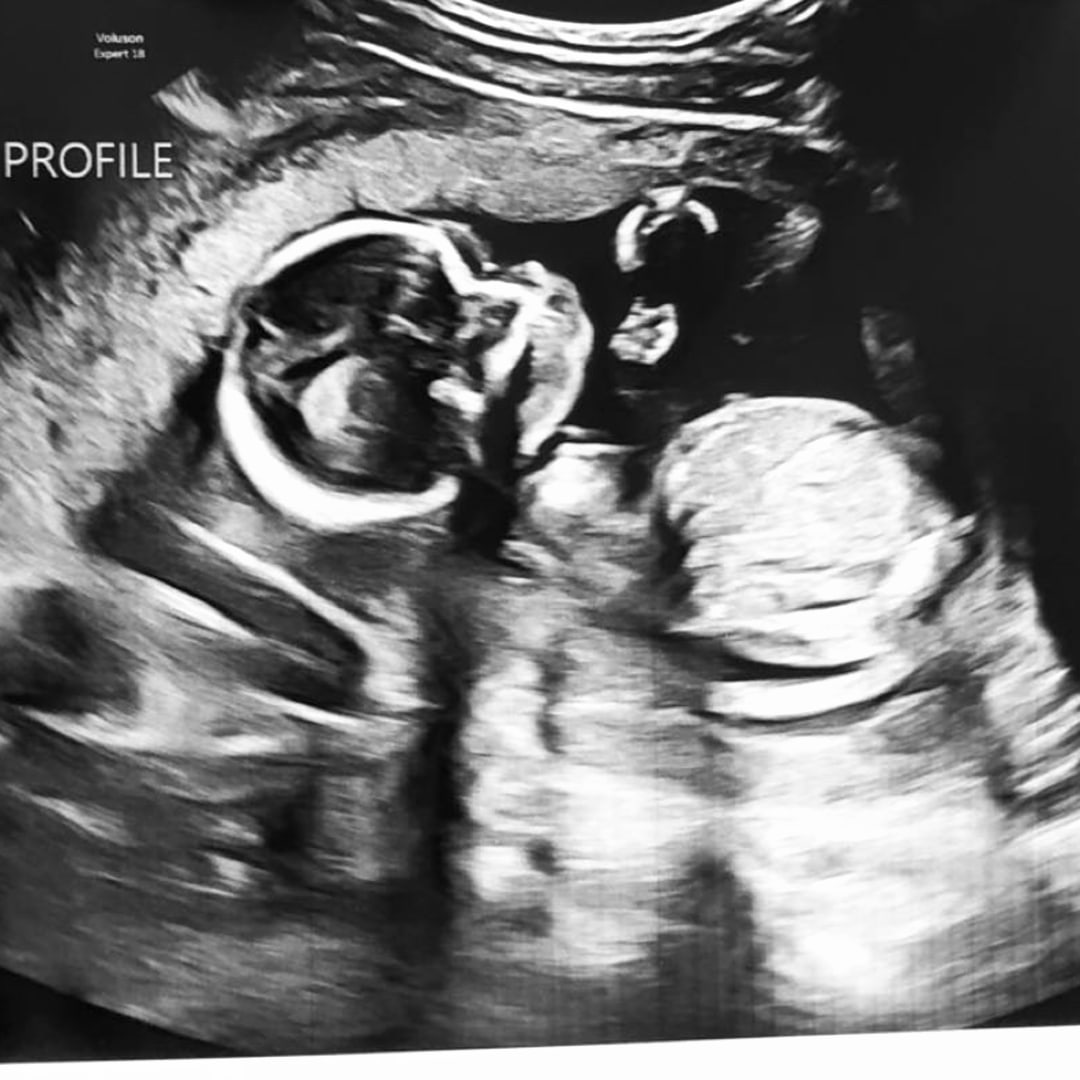 Photo shared by Faith for their Babylist baby registry.
