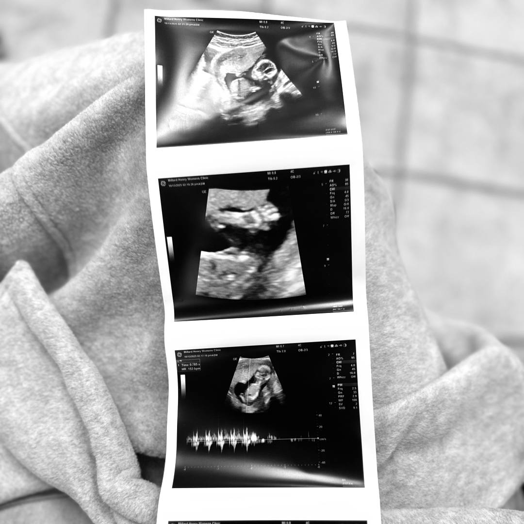 Photo shared by Emily for their Babylist baby registry.