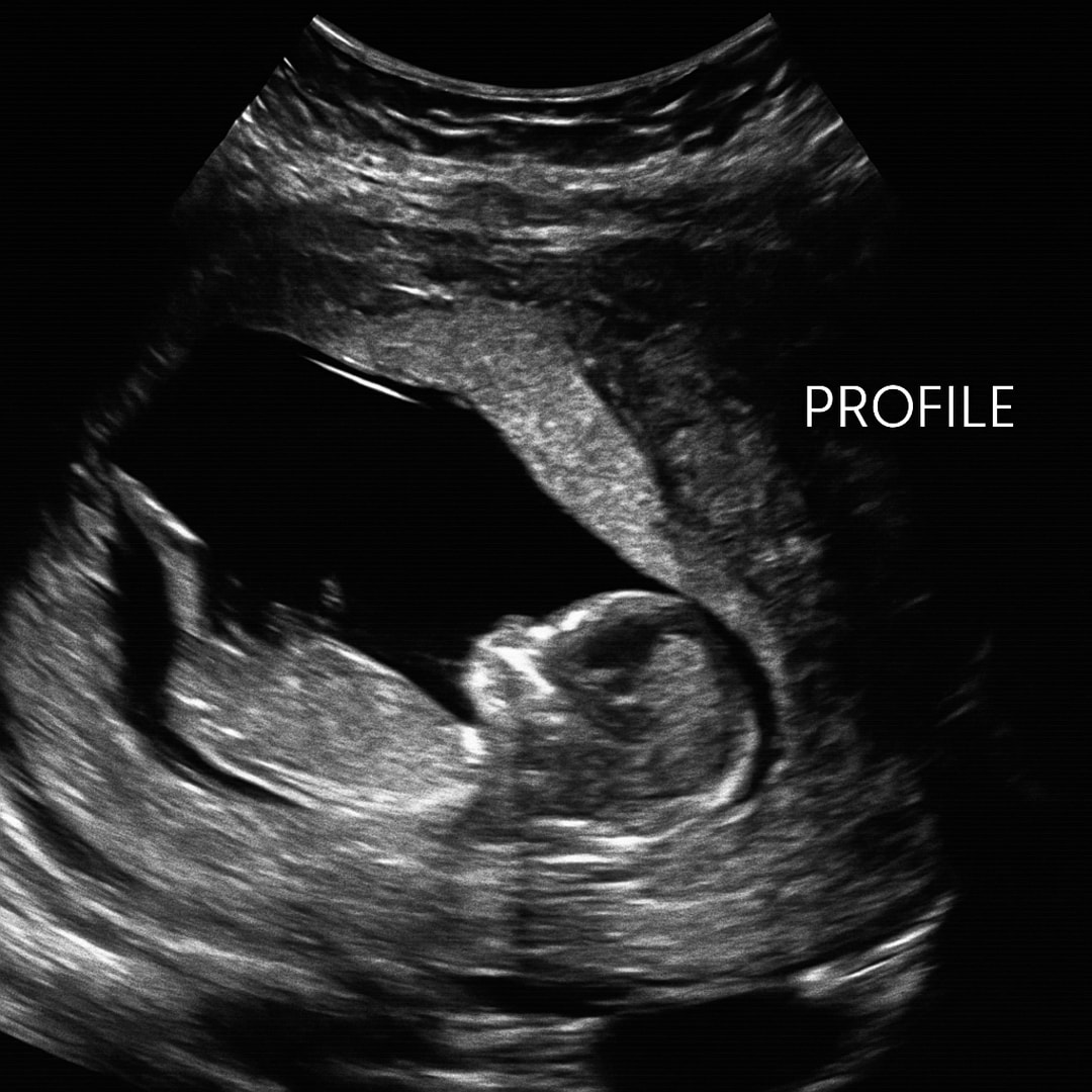 Photo shared by Lysette for their Babylist baby registry.