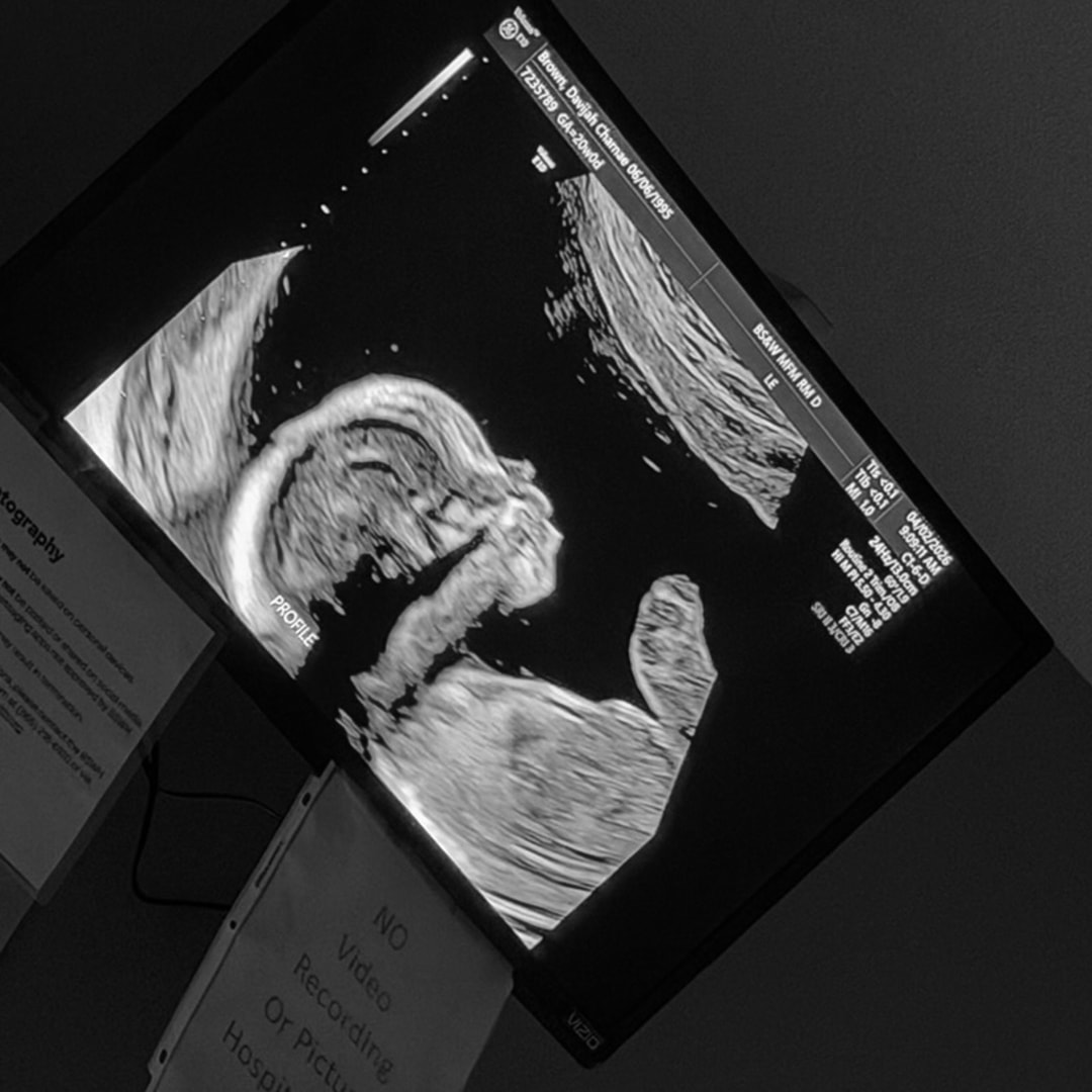 Photo shared by Vee for their Babylist baby registry.