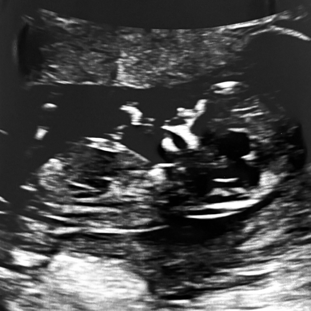 Photo shared by Denise for their Babylist baby registry.