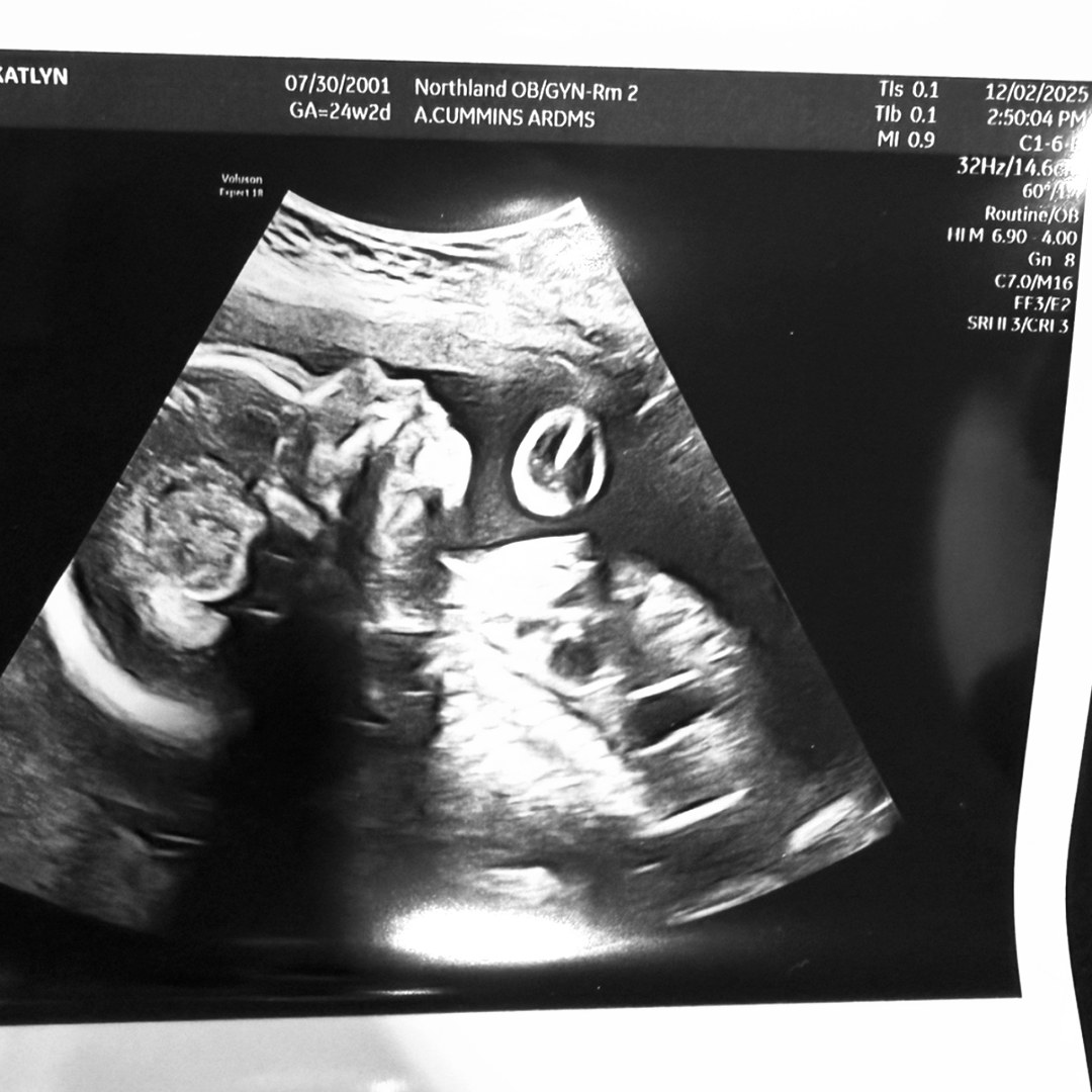 Photo shared by Katlyn for their Babylist baby registry.