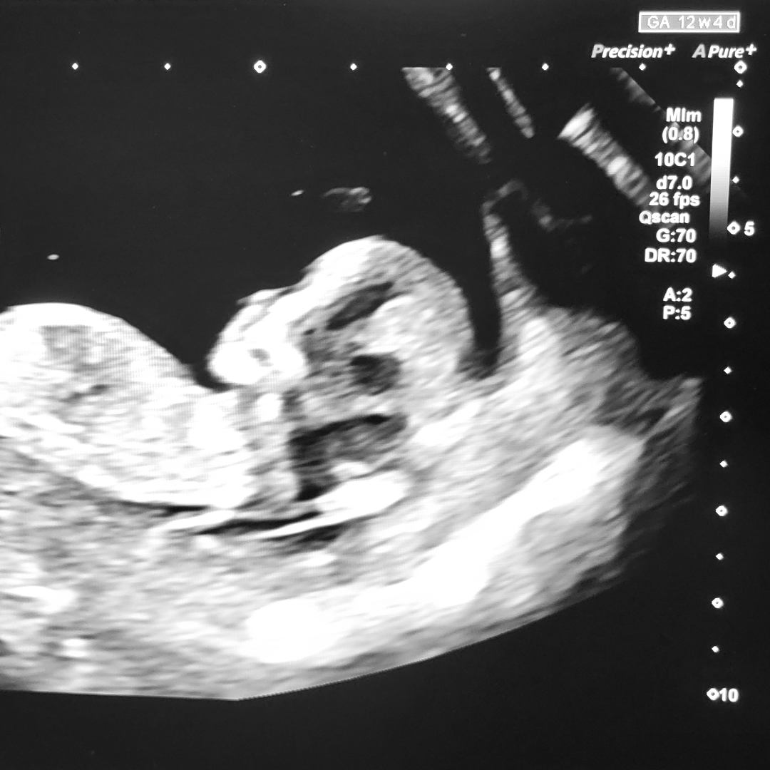 Photo shared by Jenna for their Babylist baby registry.