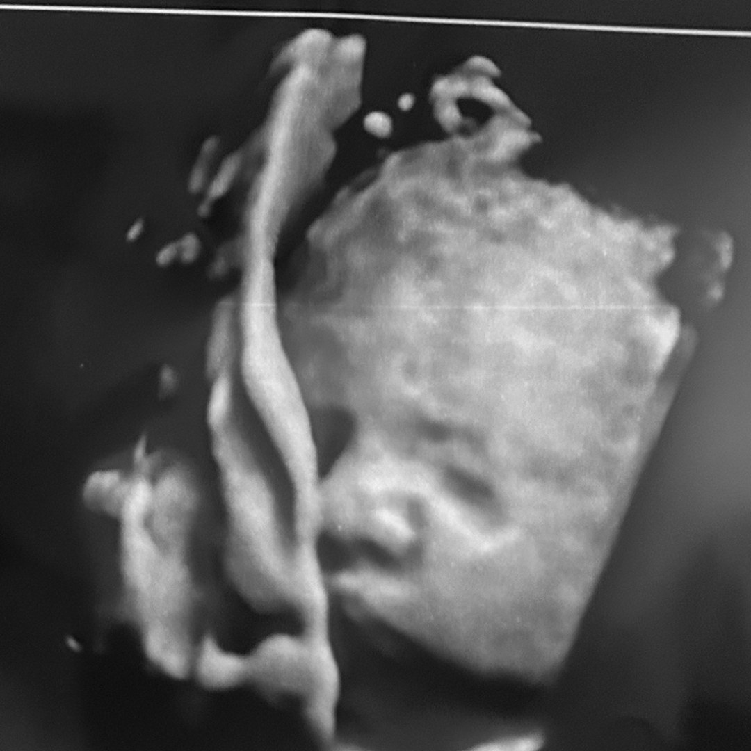 Photo shared by Cammie for their Babylist baby registry.