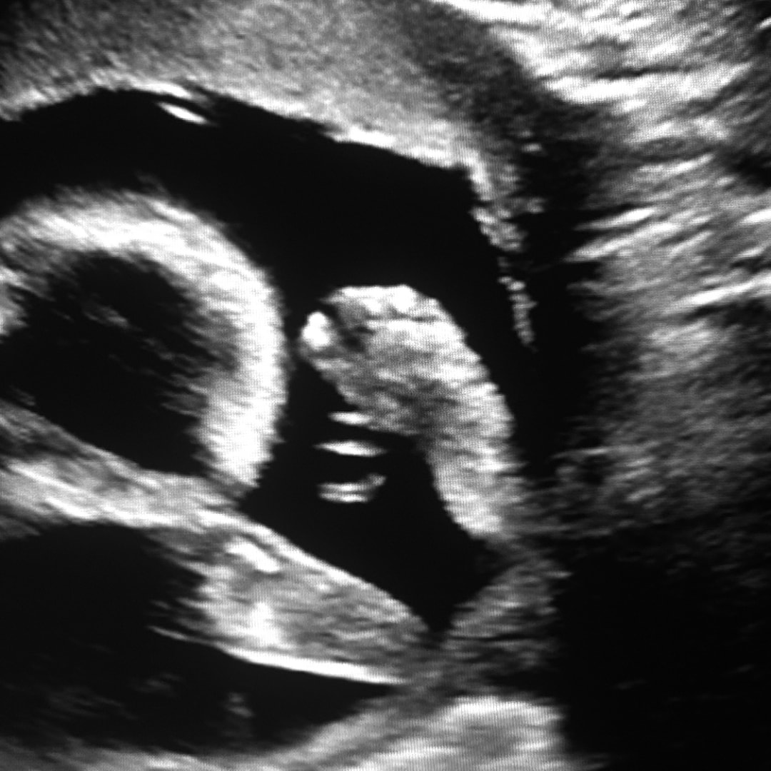 Photo shared by Inez for their Babylist baby registry.