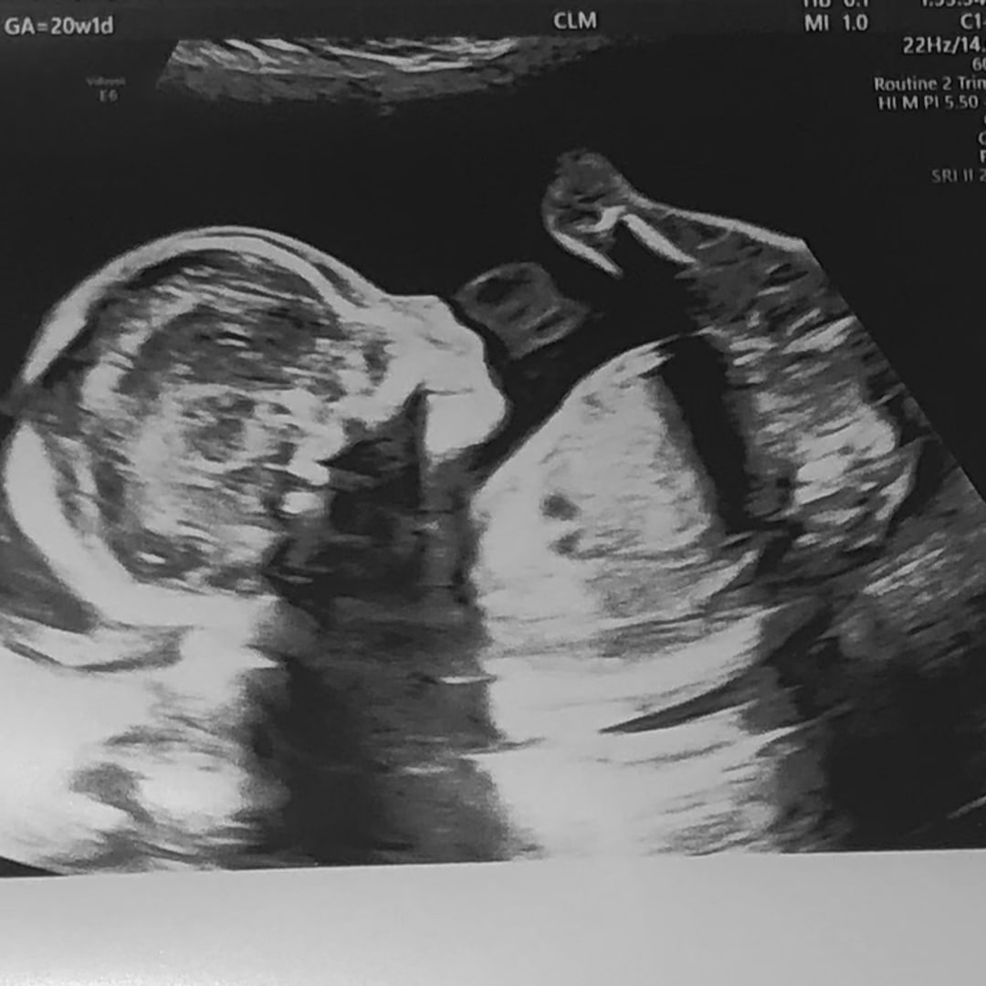 Photo shared by Elizabeth for their Babylist baby registry.