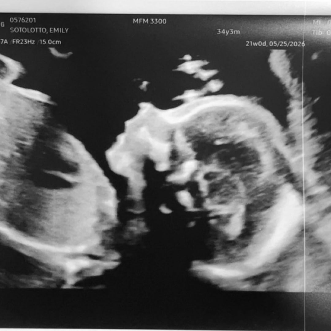 Photo shared by Emily for their Babylist baby registry.