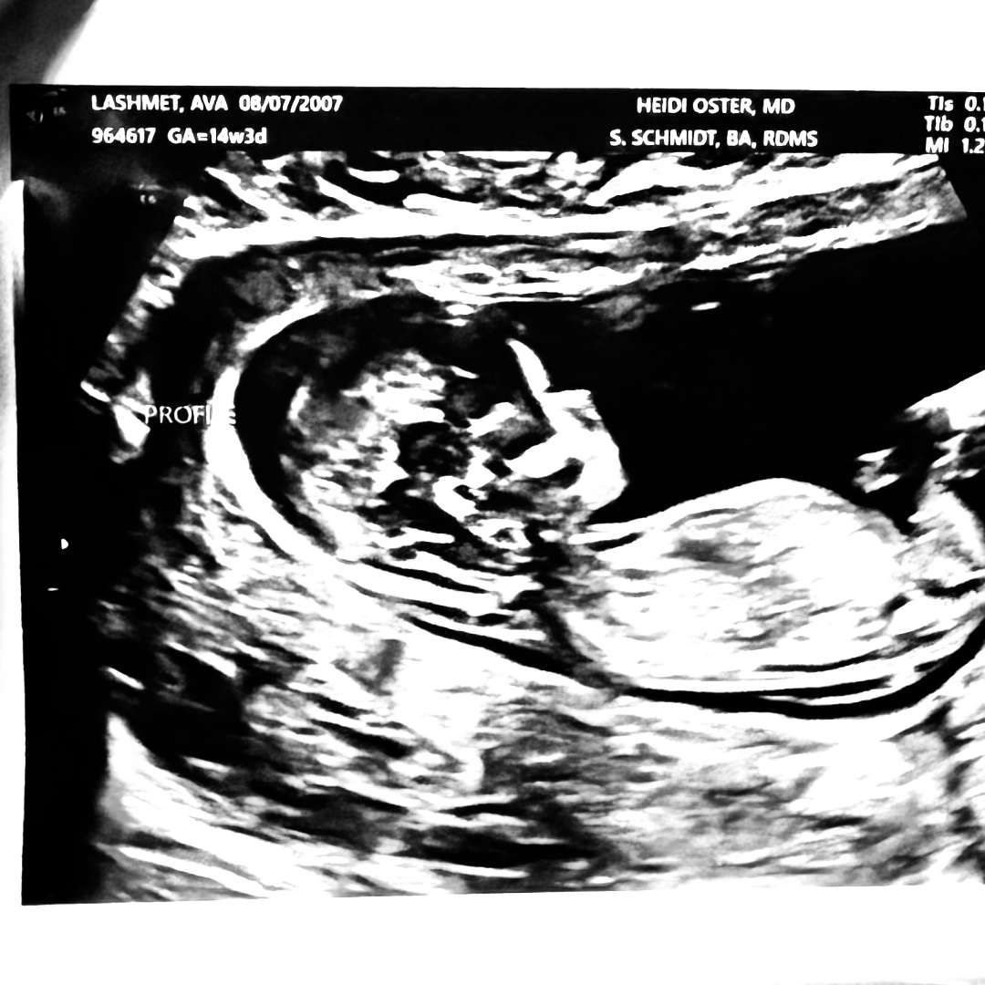 Photo shared by Ava for their Babylist baby registry.